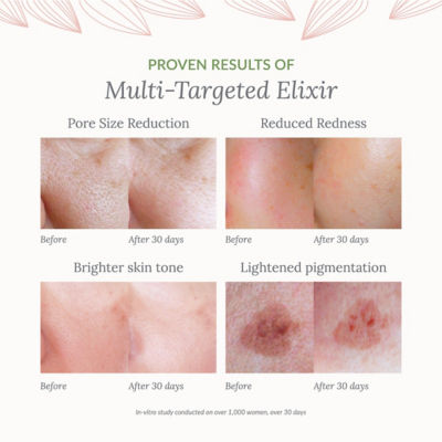 RE:ERTH Multi-Targeted Elixir 3