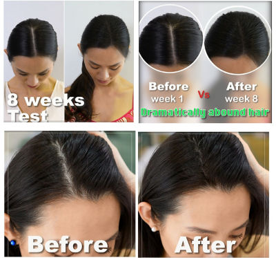Buy Smib Hair Scalp Essence For Hair Growth Stimulate Hair Loss Scalp Care Therapy Suitable For Oily Scalp Postpartum Online Singapore Ishopchangi