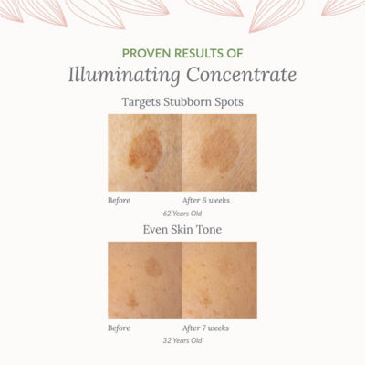 RE:ERTH Illuminating Concentrate Recruitment Set 2