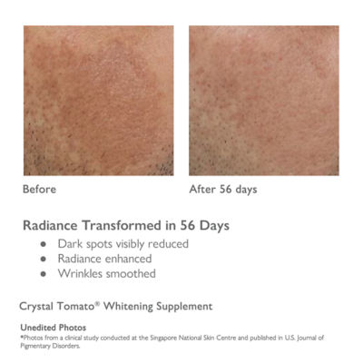  Crystal Tomato Crystal Tomato® Whitening Supplement 4