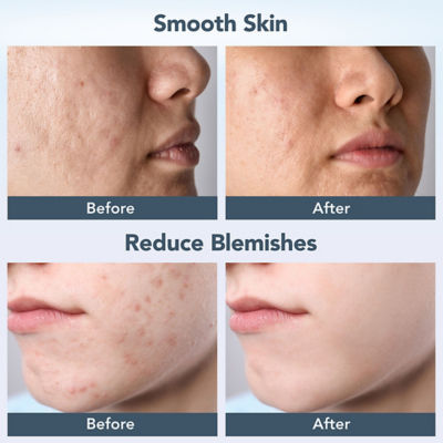 FOREO NEW FOREO Skin Luna 4 #Balanced Skin 11
