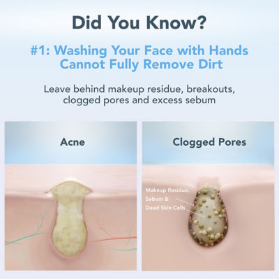 FOREO NEW FOREO Skin Luna 4 #Balanced Skin 6