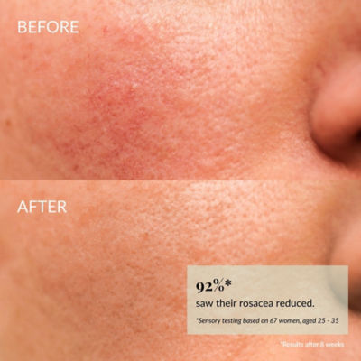 IREN Shizen  KEEP CALM Soothing Serum 5