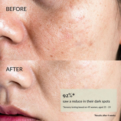 IREN Shizen  STAR LIGHT Brightening Serum 5