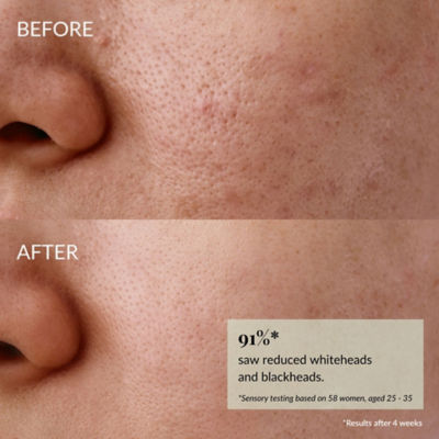 IREN Shizen  GLOW-GETTER Renewal Serum 5