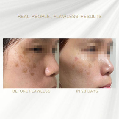 HEURE Flawless Serum 5