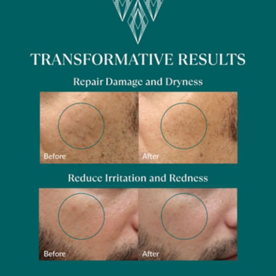 RE:ERTH Omni Serum 4
