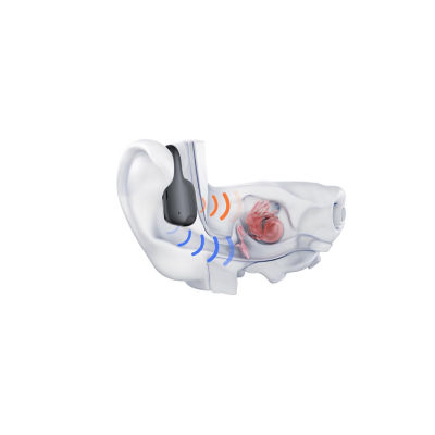 Shokz Openrun Pro 2 Bone Conduction Sport Headphones 13