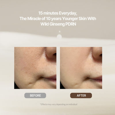 Milk Touch Wild Ginseng Gold PDRN Daily Special Mask (30pcs) 3