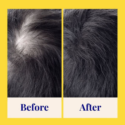 The Powder Shampoo [BUNDLE] 1 x Invigorating Shampoo For Thinning and Ageing Hair 20g + 1 x Energising Body Foam Wash For All Skin Types 20g 4