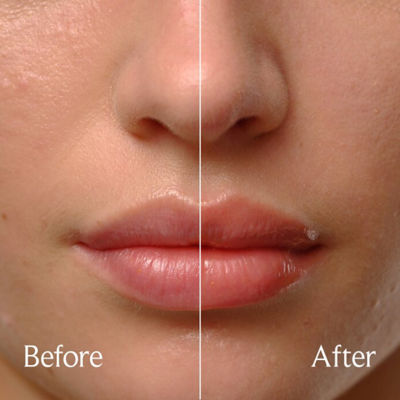 FRESH Sugar Lip Treatment Oil 5
