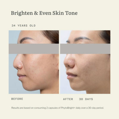 RE:ERTH Brighter Side Set 5
