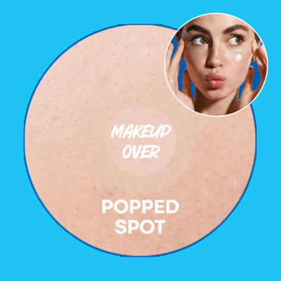 Nolahour [Bundle] Spot Eraser Green 9 Patch + Spot Eraser Blue 63 Patch 5