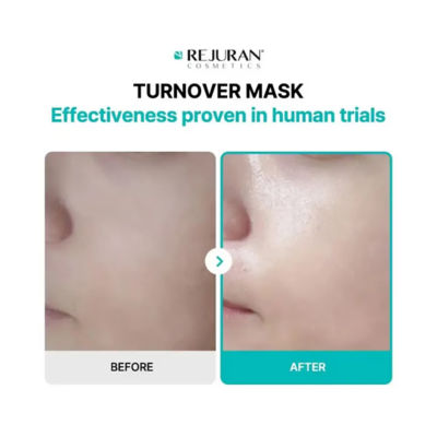 Rejuran Turnover Mask 5pcs 4