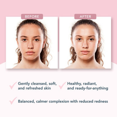 FOREO 斐珞尔 For Everyone Skin Unmasked Probiotic Jelly Cleanser 7