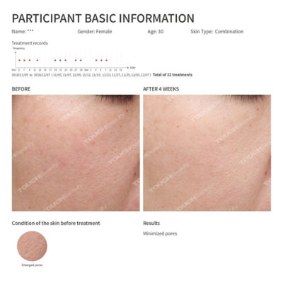 Touch Beauty TOUCHBeauty Hot & Cool Skin Device (TB-1589) 5