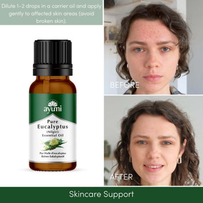 Ayumi Pure Eucalyptus Essential Oil 20ml 10