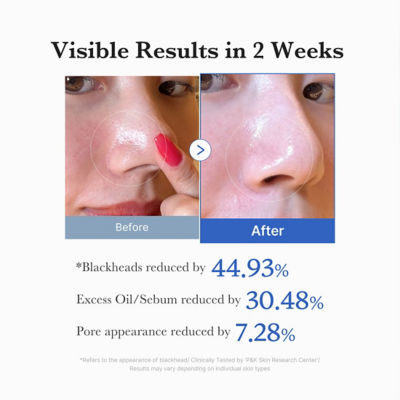MEDICUBE Zero Pore Pad 2.0 5