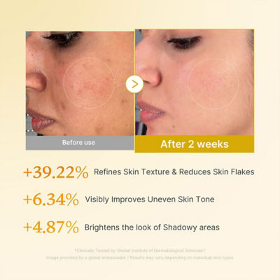 MEDICUBE Kojic Acid Turmeric Resurfacing Toner 4