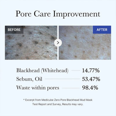 MEDICUBE Zero Pore Blackhead Mud Mask 5