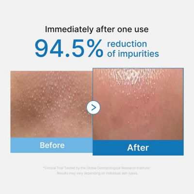 MEDICUBE Zero Pore Blackhead Deep Cleansing Oil 2