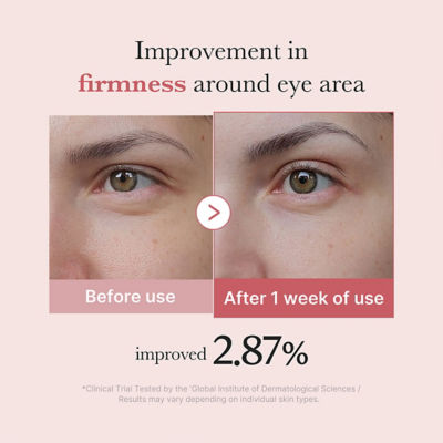 MEDICUBE PDRN Pink Peptide Eyecream 4