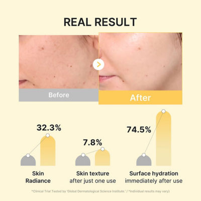 MEDICUBE Kojic Acid Turmeric Brightening Gel Mask 3