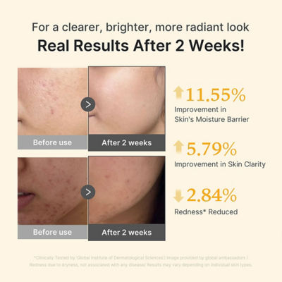 MEDICUBE Kojic Acid Turmeric Niacinamide Serum 4