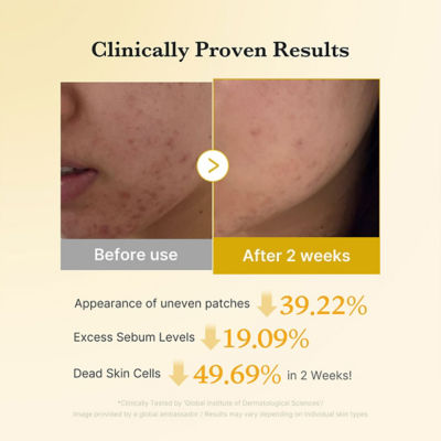 MEDICUBE Kojic Acid Turmeric Pad 4