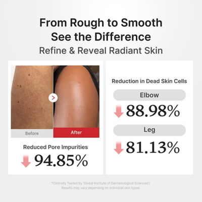 MEDICUBE Hypochlorous Acid Body Peel Shot 4