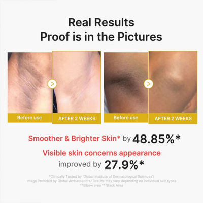 MEDICUBE Kojic Acid Turmeric Body Peel Shot 3