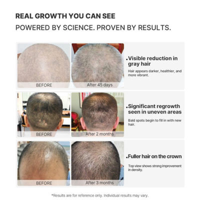 Touch Beauty TOUCHBeauty VITA Scalp Rejuvenating Graphene Helmet (TB-2546) 6