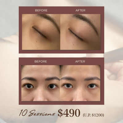 Estetica 45 Mins Meridian Detox Eye Treatment 3