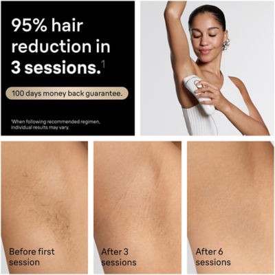 Braun PL5221 IPL Silk·expert Pro 5 Effective Hair Removal 5